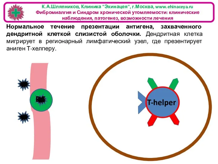 К.А.Шляпников, Клиника "Эхинацея", г.Москва, www.ehinaceya.ru Фибромиалгия и Синдром хронической утомляемости: клинические наблюдения,