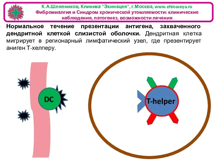 К.А.Шляпников, Клиника "Эхинацея", г.Москва, www.ehinaceya.ru Фибромиалгия и Синдром хронической утомляемости: клинические наблюдения,