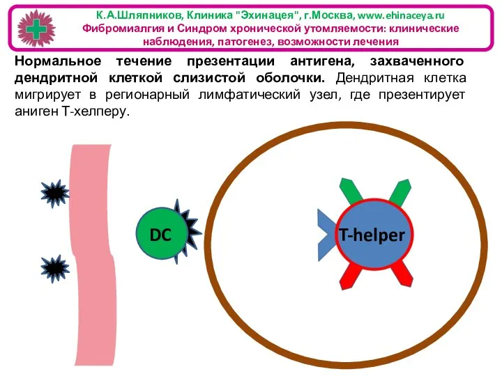 К.А.Шляпников, Клиника "Эхинацея", г.Москва, www.ehinaceya.ru Фибромиалгия и Синдром хронической утомляемости: клинические наблюдения,