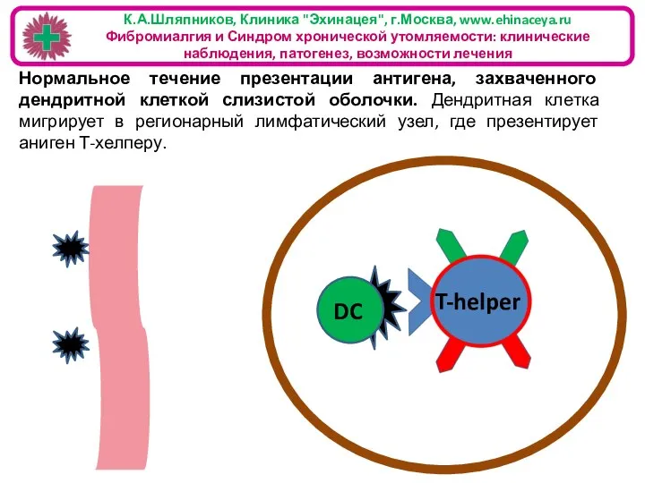 К.А.Шляпников, Клиника "Эхинацея", г.Москва, www.ehinaceya.ru Фибромиалгия и Синдром хронической утомляемости: клинические наблюдения,