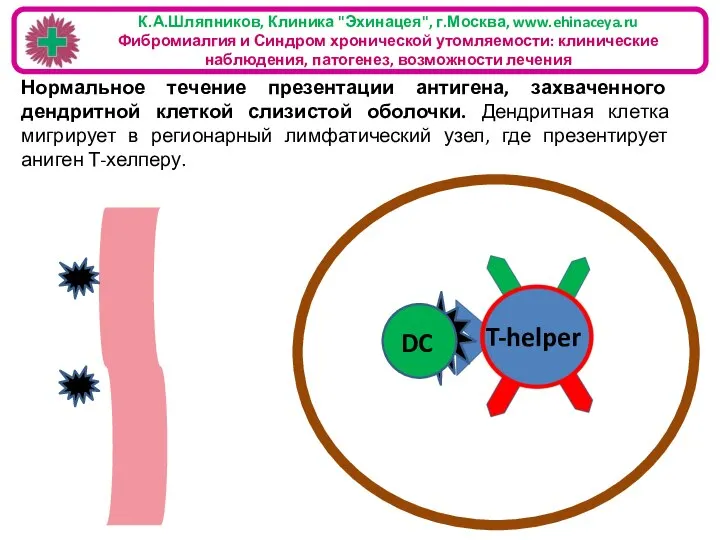 К.А.Шляпников, Клиника "Эхинацея", г.Москва, www.ehinaceya.ru Фибромиалгия и Синдром хронической утомляемости: клинические наблюдения,