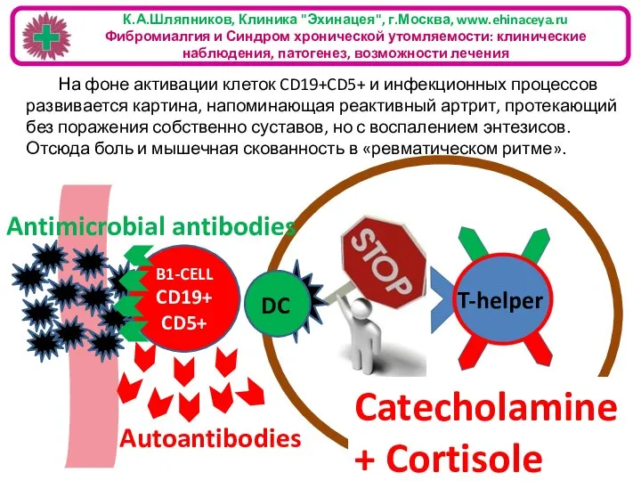 На фоне активации клеток CD19+CD5+ и инфекционных процессов развивается картина, напоминающая реактивный