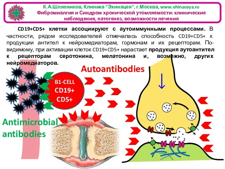 B1-CELL CD19+ CD5+ К.А.Шляпников, Клиника "Эхинацея", г.Москва, www.ehinaceya.ru Фибромиалгия и Синдром хронической