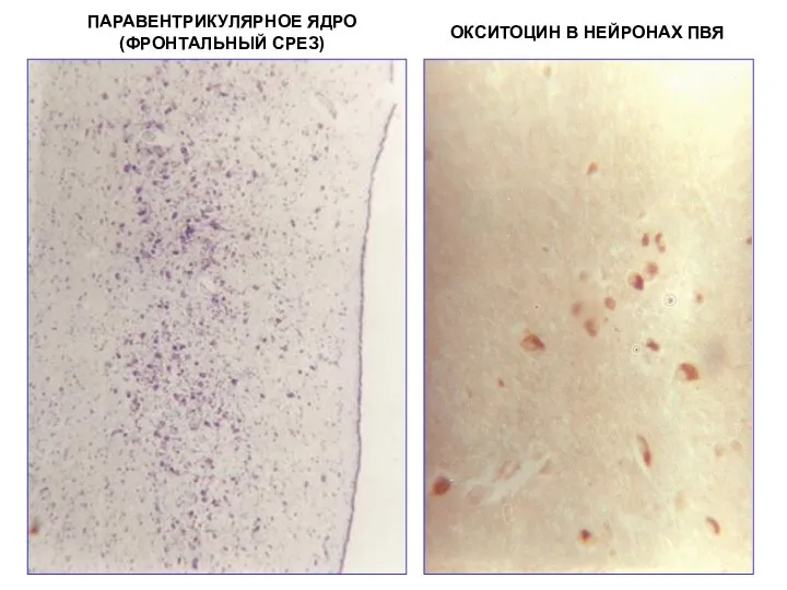 ПАРАВЕНТРИКУЛЯРНОЕ ЯДРО (ФРОНТАЛЬНЫЙ СРЕЗ) ОКСИТОЦИН В НЕЙРОНАХ ПВЯ