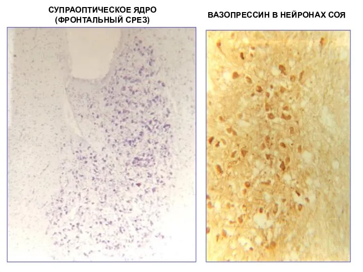 СУПРАОПТИЧЕСКОЕ ЯДРО (ФРОНТАЛЬНЫЙ СРЕЗ) ВАЗОПРЕССИН В НЕЙРОНАХ СОЯ