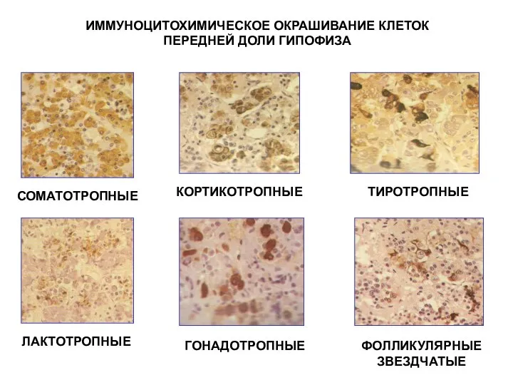 ИММУНОЦИТОХИМИЧЕСКОЕ ОКРАШИВАНИЕ КЛЕТОК ПЕРЕДНЕЙ ДОЛИ ГИПОФИЗА СОМАТОТРОПНЫЕ ЛАКТОТРОПНЫЕ КОРТИКОТРОПНЫЕ ГОНАДОТРОПНЫЕ ТИРОТРОПНЫЕ ФОЛЛИКУЛЯРНЫЕ ЗВЕЗДЧАТЫЕ