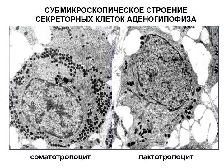 СУБМИКРОСКОПИЧЕСКОЕ СТРОЕНИЕ СЕКРЕТОРНЫХ КЛЕТОК АДЕНОГИПОФИЗА соматотропоцит лактотропоцит