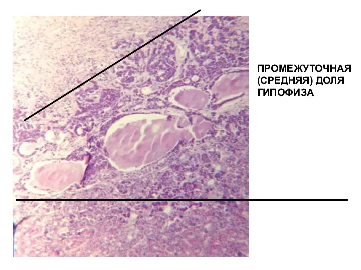 ПРОМЕЖУТОЧНАЯ (СРЕДНЯЯ) ДОЛЯ ГИПОФИЗА