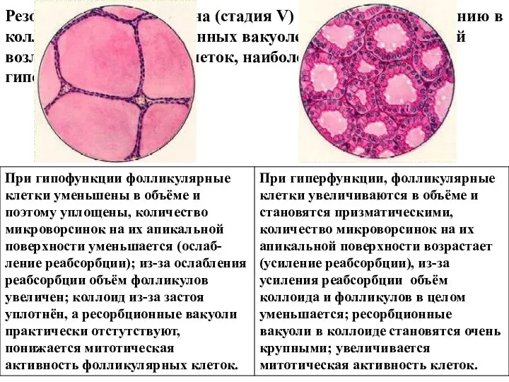 Резорбция тиреоглобулина (стадия V) приводит к образованию в коллоиде т.н. резорбционных вакуолей