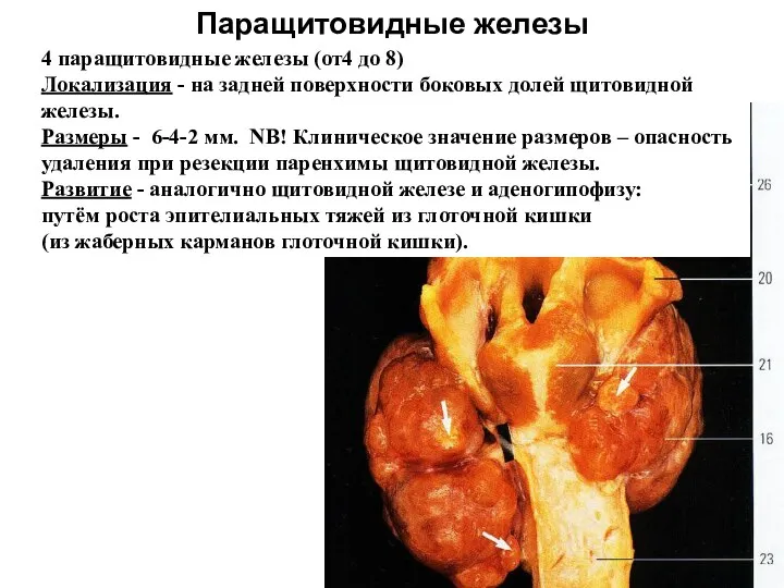 Паращитовидные железы 4 паращитовидные железы (от4 до 8) Локализация - на задней