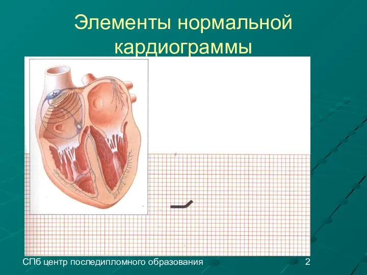 СПб центр последипломного образования Элементы нормальной кардиограммы
