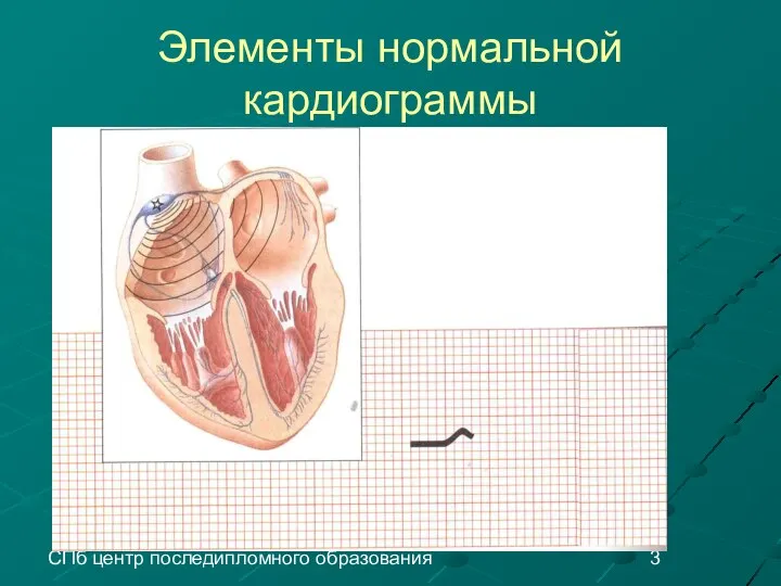 СПб центр последипломного образования Элементы нормальной кардиограммы