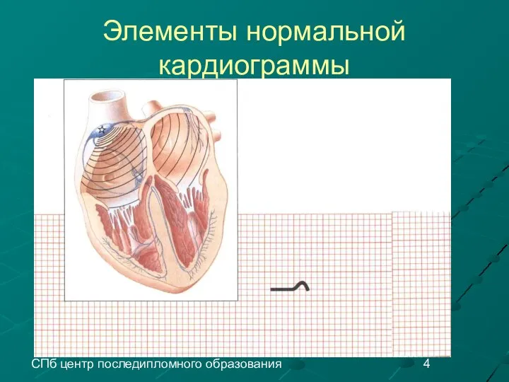 СПб центр последипломного образования Элементы нормальной кардиограммы