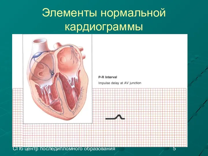 СПб центр последипломного образования Элементы нормальной кардиограммы