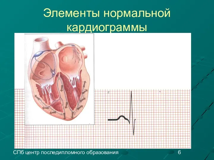 СПб центр последипломного образования Элементы нормальной кардиограммы