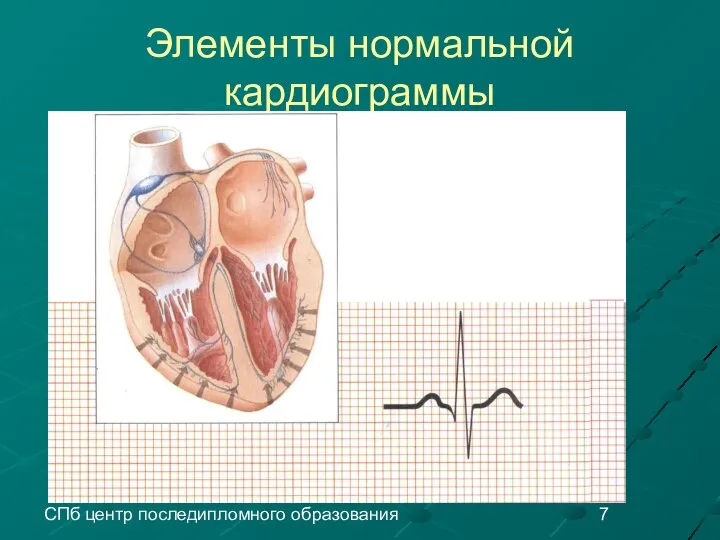 СПб центр последипломного образования Элементы нормальной кардиограммы