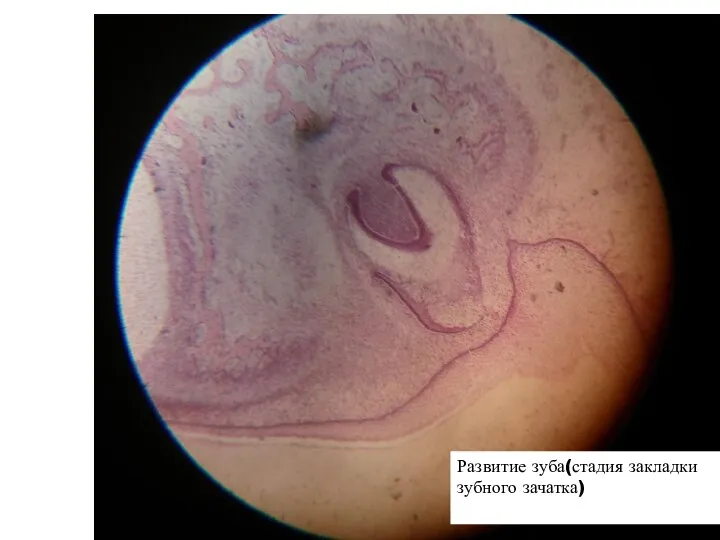 Развитие зуба(стадия закладки зубного зачатка)