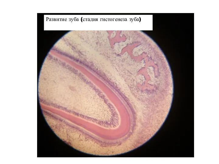 Развитие зуба (стадия гистогенеза зуба)