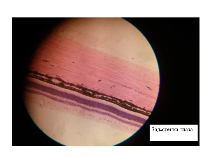 Зад.стенка глаза