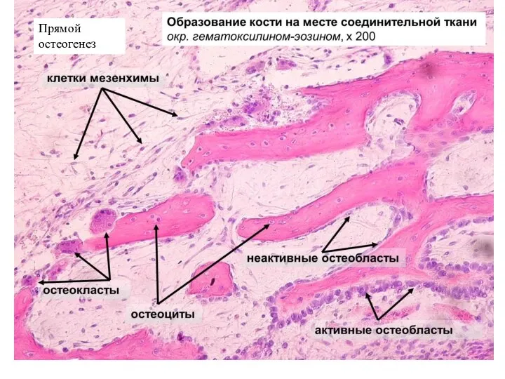 Прямой остеогенез