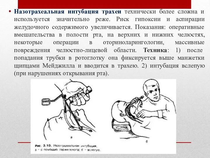 Назотрахеальная интубация трахеи технически более сложна и используется значительно реже. Риск гипоксии