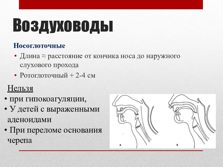 Воздуховоды Носоглоточные Длина ≈ расстояние от кончика носа до наружного слухового прохода