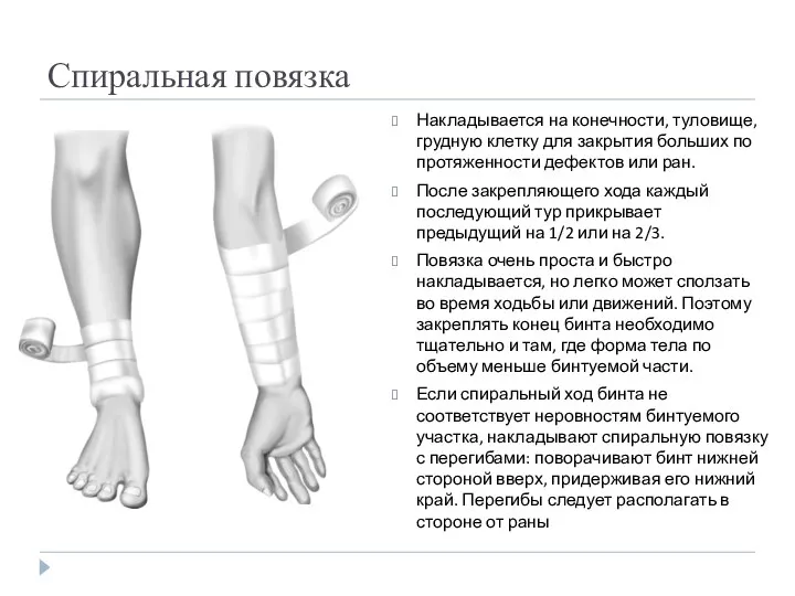 Спиральная повязка Накладывается на конечности, туловище, грудную клетку для закрытия больших по