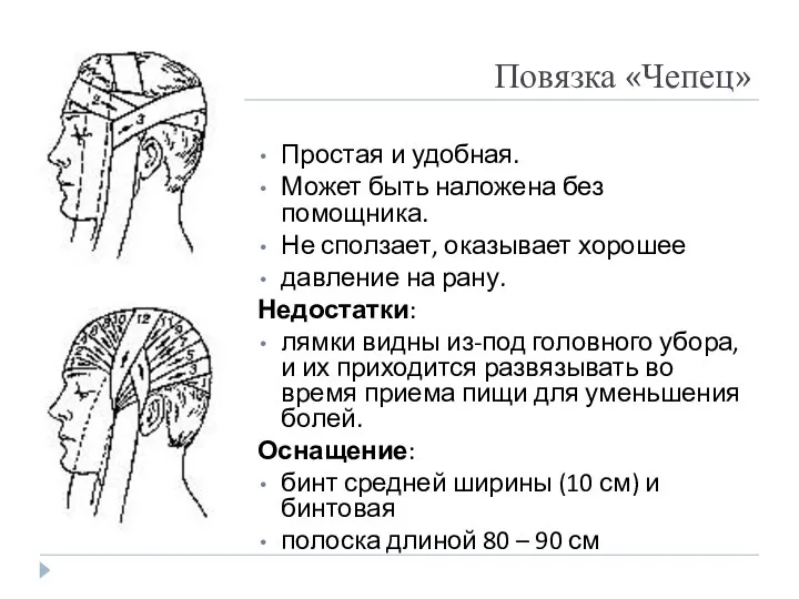 Повязка «Чепец» Простая и удобная. Может быть наложена без помощника. Не сползает,