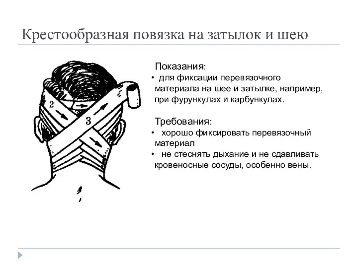 Крестообразная повязка на затылок и шею Показания: для фиксации перевязочного материала на