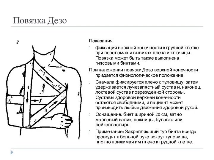 Повязка Дезо Показания: фиксация верхней конечности к грудной клетке при переломах и