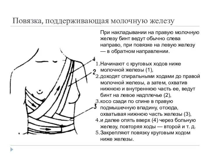 Повязка, поддерживающая молочную железу При накладывании на правую молочную железу бинт ведут