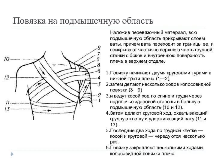 Повязка на подмышечную область Наложив перевязочный материал, всю подмышечную область прикрывают слоем