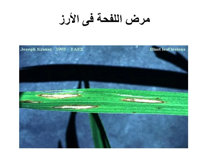 مرض اللفحة فى الأرز