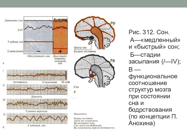 Рис. 312. Сон. А—«медленный» и «быстрый» сон; Б—стадии засыпания (/—IV); В —