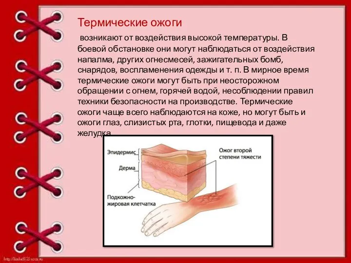 Термические ожоги возникают от воздействия высокой температуры. В боевой обстановке они могут