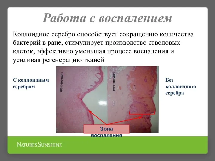 Работа с воспалением Коллоидное серебро способствует сокращению количества бактерий в ране, стимулирует