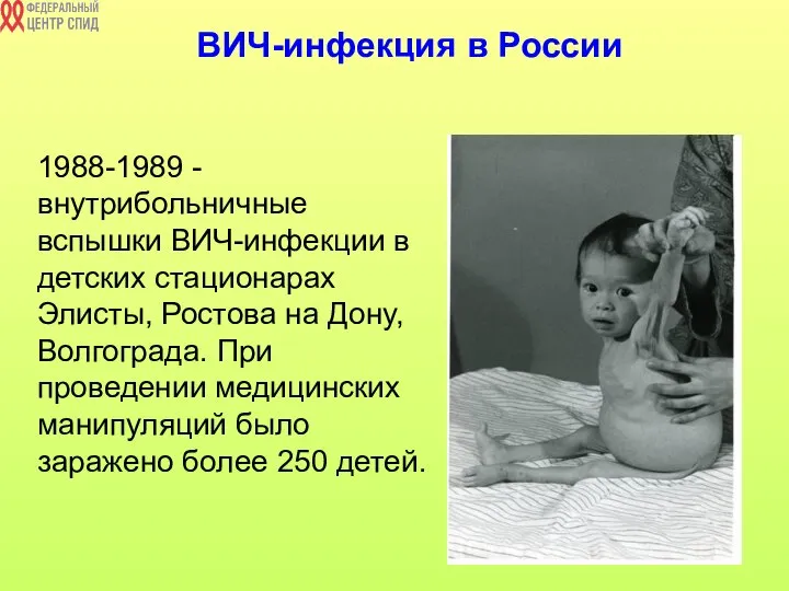 ВИЧ-инфекция в России 1988-1989 - внутрибольничные вспышки ВИЧ-инфекции в детских стационарах Элисты,