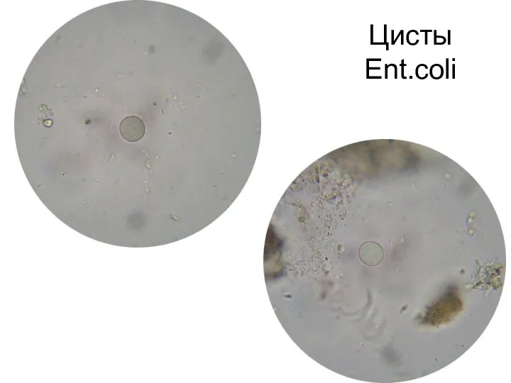 Цисты Ent.coli