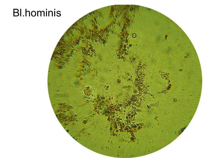 Bl.hominis