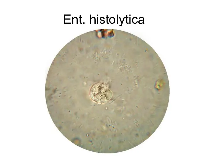 Ent. histolytica