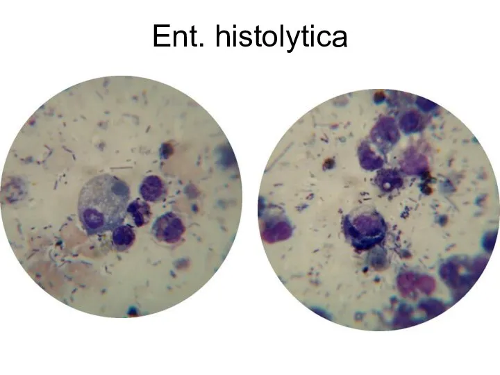 Ent. histolytica