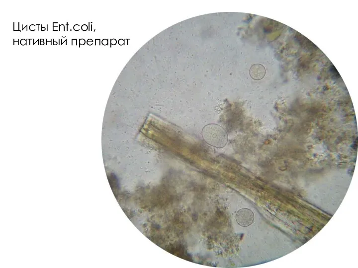 Цисты Ent.coli, нативный препарат