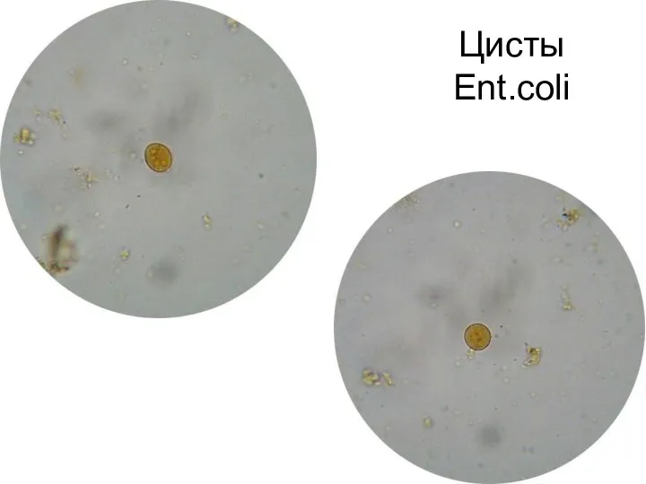 Цисты Ent.coli