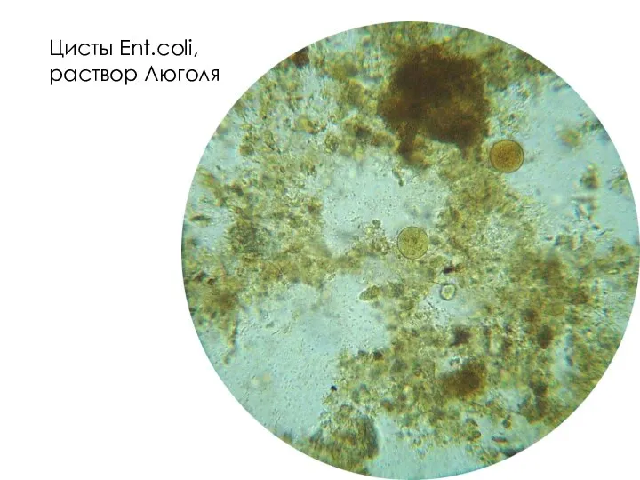 Цисты Ent.coli, раствор Люголя