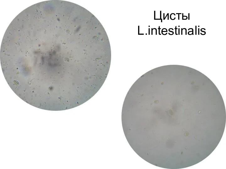 Цисты L.intestinalis