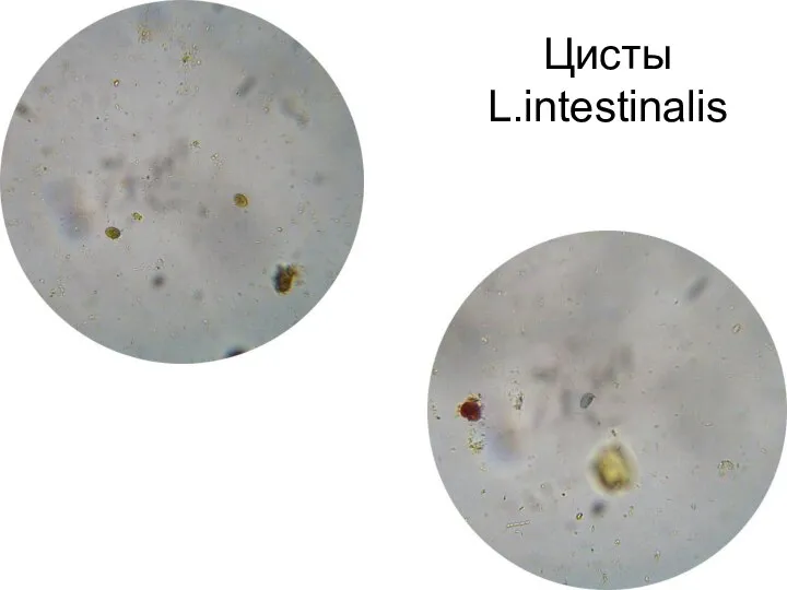 Цисты L.intestinalis