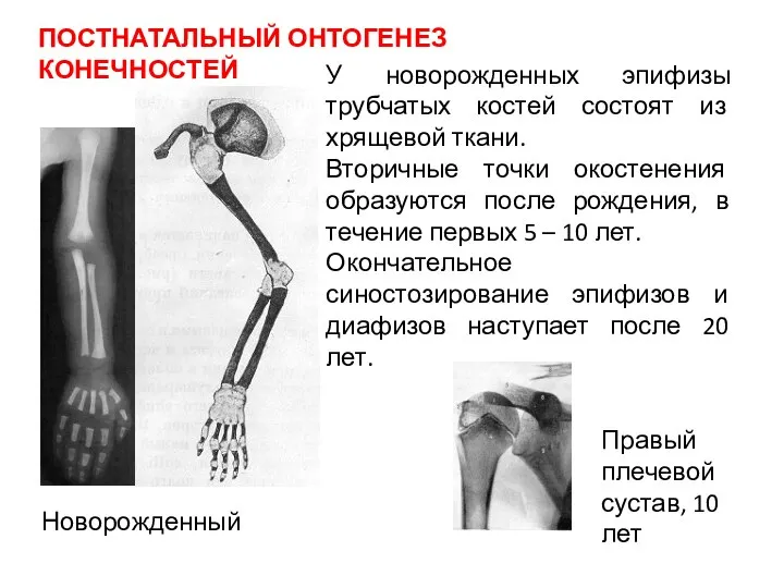 Новорожденный Правый плечевой сустав, 10 лет У новорожденных эпифизы трубчатых костей состоят