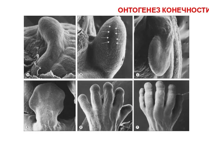 ОНТОГЕНЕЗ КОНЕЧНОСТИ