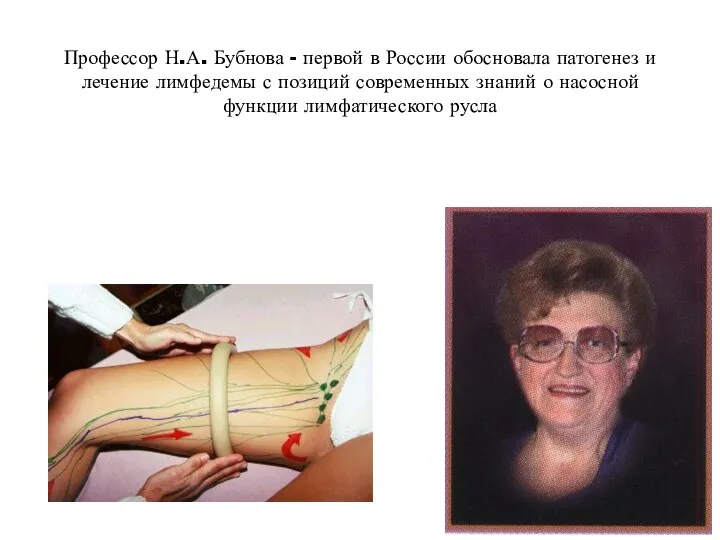 Профессор Н.А. Бубнова - первой в России обосновала патогенез и лечение лимфедемы