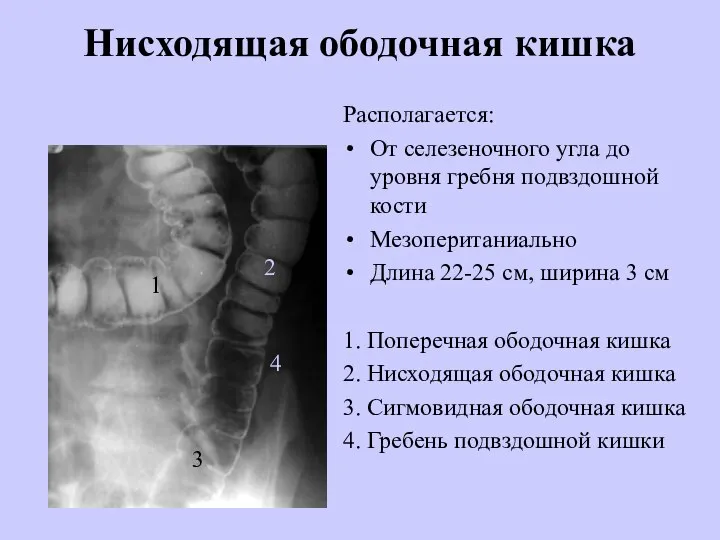 Нисходящая ободочная кишка Располагается: От селезеночного угла до уровня гребня подвздошной кости